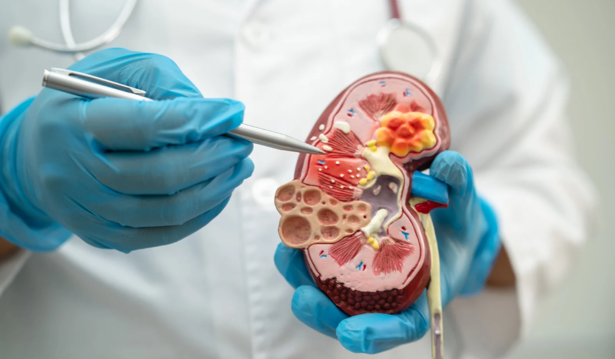 <span style="font-weight: bold;">Консультация уролога</span>